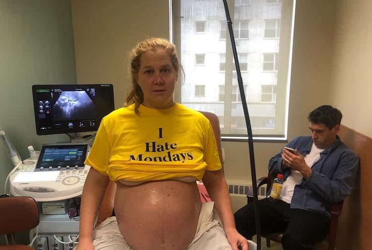 Amy Schumer Shares Name, First Photos of Baby Boy