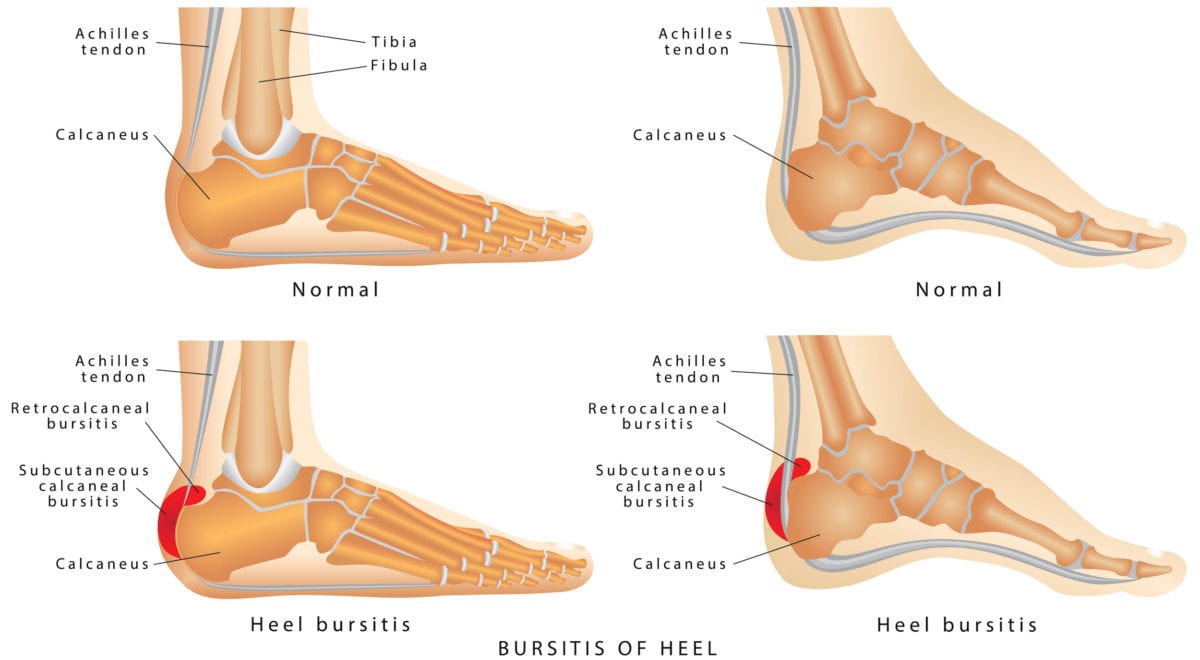 Swollen Feet? Read about 8 Medical Conditions That Can Cause Feet to Swell Up | When people think of swollen feet, most consider the most common causes for the symptom: pregnancy, injury, or a job that requires a lot of walking. But many get swollen feet when these things aren’t the case. In those situations, what’s the cause?