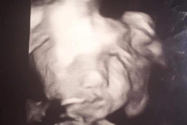 Devil Baby Sonogram