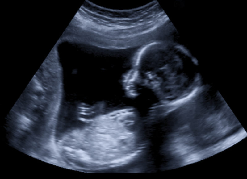 Ultrasound Baby