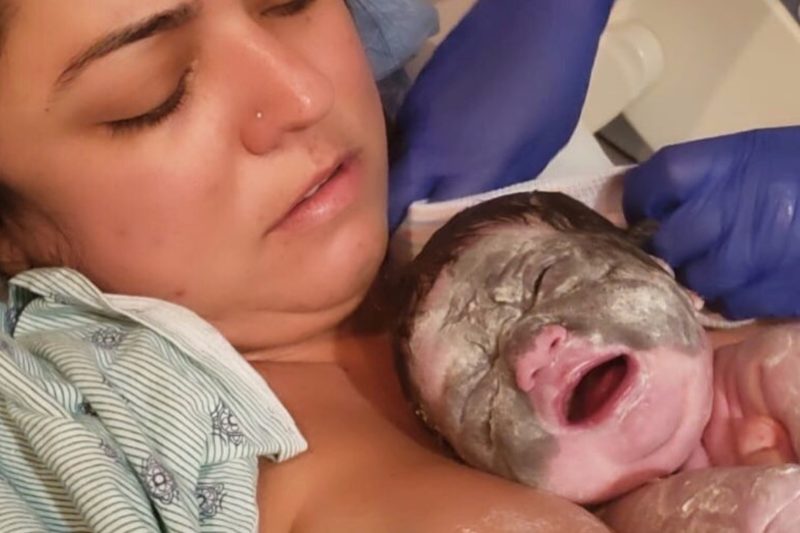 6-Month-Old American to Have Batman-Shaped Face Patch Removed in Series of Surgeries in Russia | 6-month-old Luna Fenner was born with congenital melanocytic nevus, a rare skin condition that causes an "abnormally dark" patch to appear on the skin. Luna's patch, which appears on a large portion of her face, is said to look like the Batman symbol.