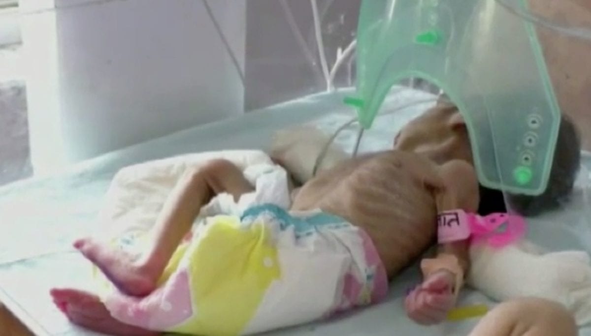 Newborn buried alive