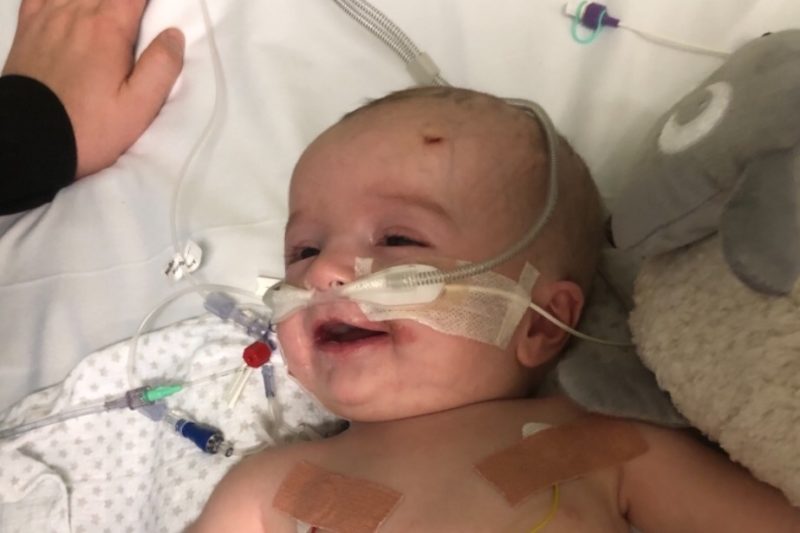 Michael Labuschagne: Baby with Rare Tumor Who Awoke from a Coma with a Smile Needs Life-Saving Surgery in Boston