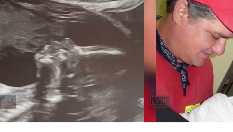 Mom Stunned After Friend Starting Seeing Her Late Dad Kissing His Granddaughter in Latest Sonogram Picture