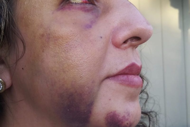 A California Mom Was Reportedly Beaten Up by the Same Teens Who Were Bullying Her Daughter When She Went to Talk to the School Principal