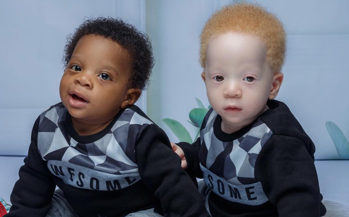 Mother's Set Of Twins Are Identical But Look Nothing Alike 