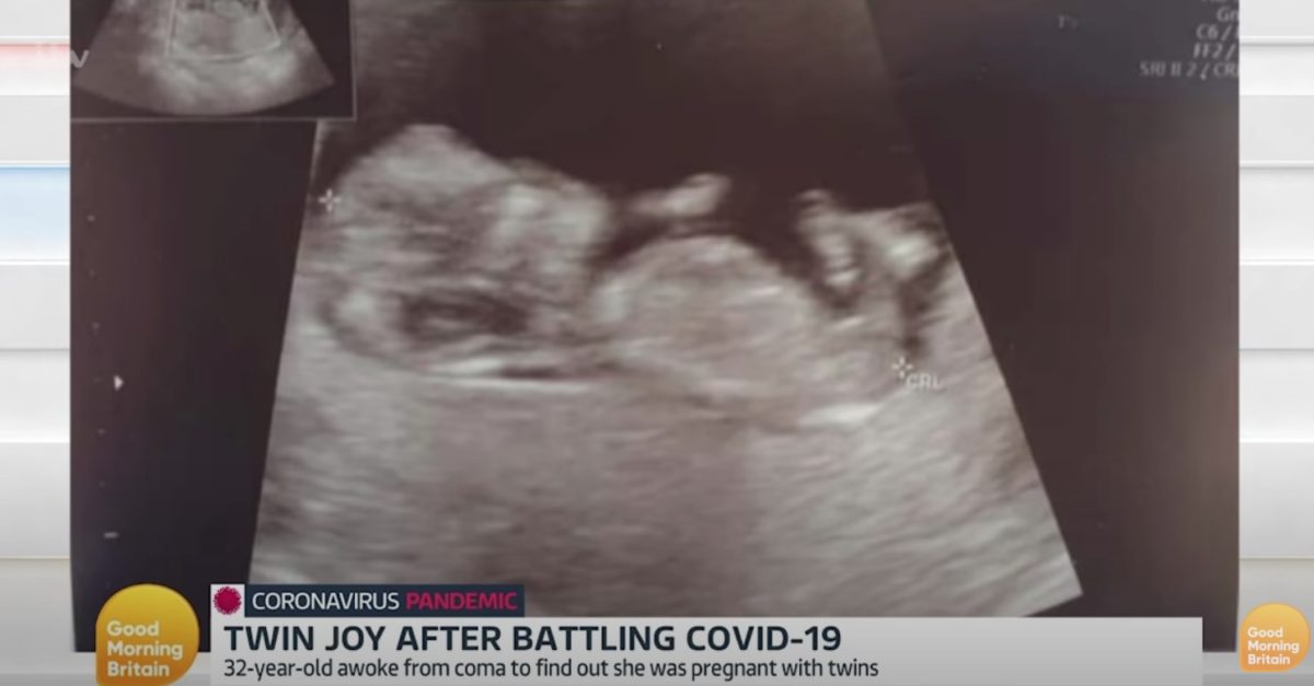 Mom Wakes From 10 Day Medically Induced Coma After Contracting COVID-19, She Also Learns She Pregnant With Twins | "It was the cherry on top of the cake knowing I had beat coronavirus and have twins on the way!"