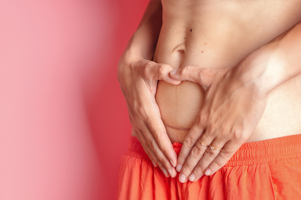 How Long Do I Have to Wait After a C-Section to Take a Bath?