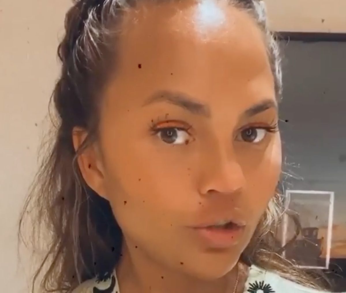 Chrissy Teigen Claps Back Over Boobs, Losing Weight & Cancer