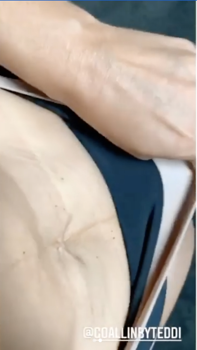 'RHOBH' Star and Mom-of-Three Teddi Mellencamp Shares Video of Her Post-Baby Body: Stretch Marks, Loose Skin, and All