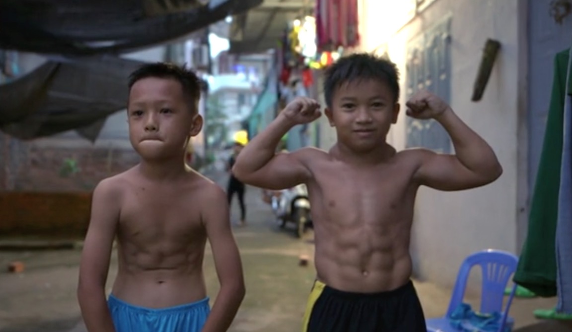 10-Year-Old Dreams of Being a Bodybuilder After Being Diagnosed With 'Superhero' Condition That Makes Him Very Muscular | The Vietnamese media is calling the "superman syndrome."