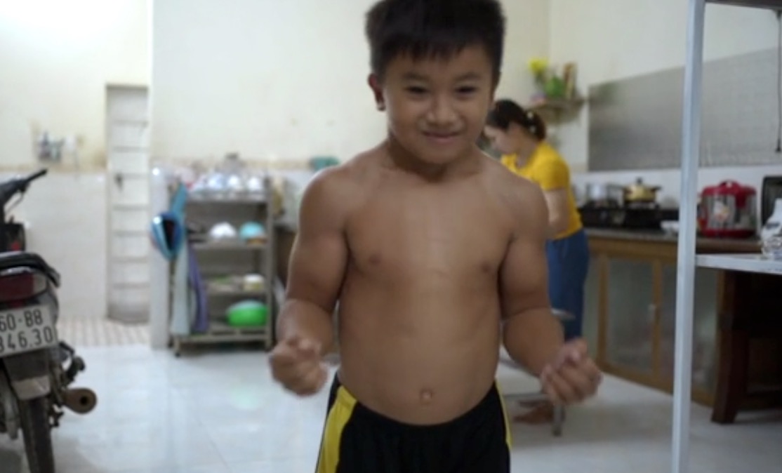 10-Year-Old Dreams of Being a Bodybuilder After Being Diagnosed With 'Superhero' Condition That Makes Him Very Muscular | The Vietnamese media is calling the "superman syndrome."