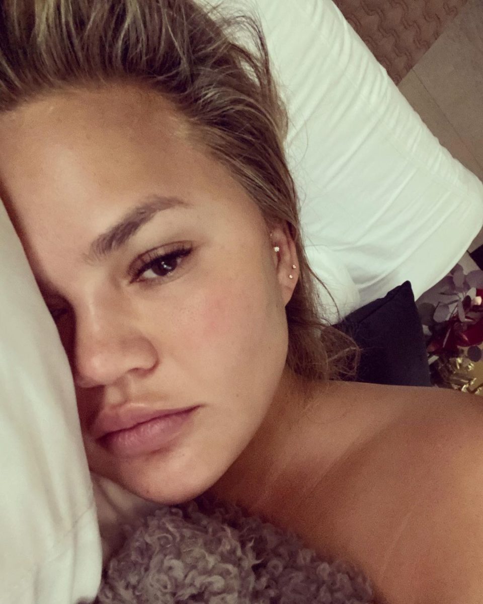 Chrissy Teigen Defends Riding Horse Amid Pandemic