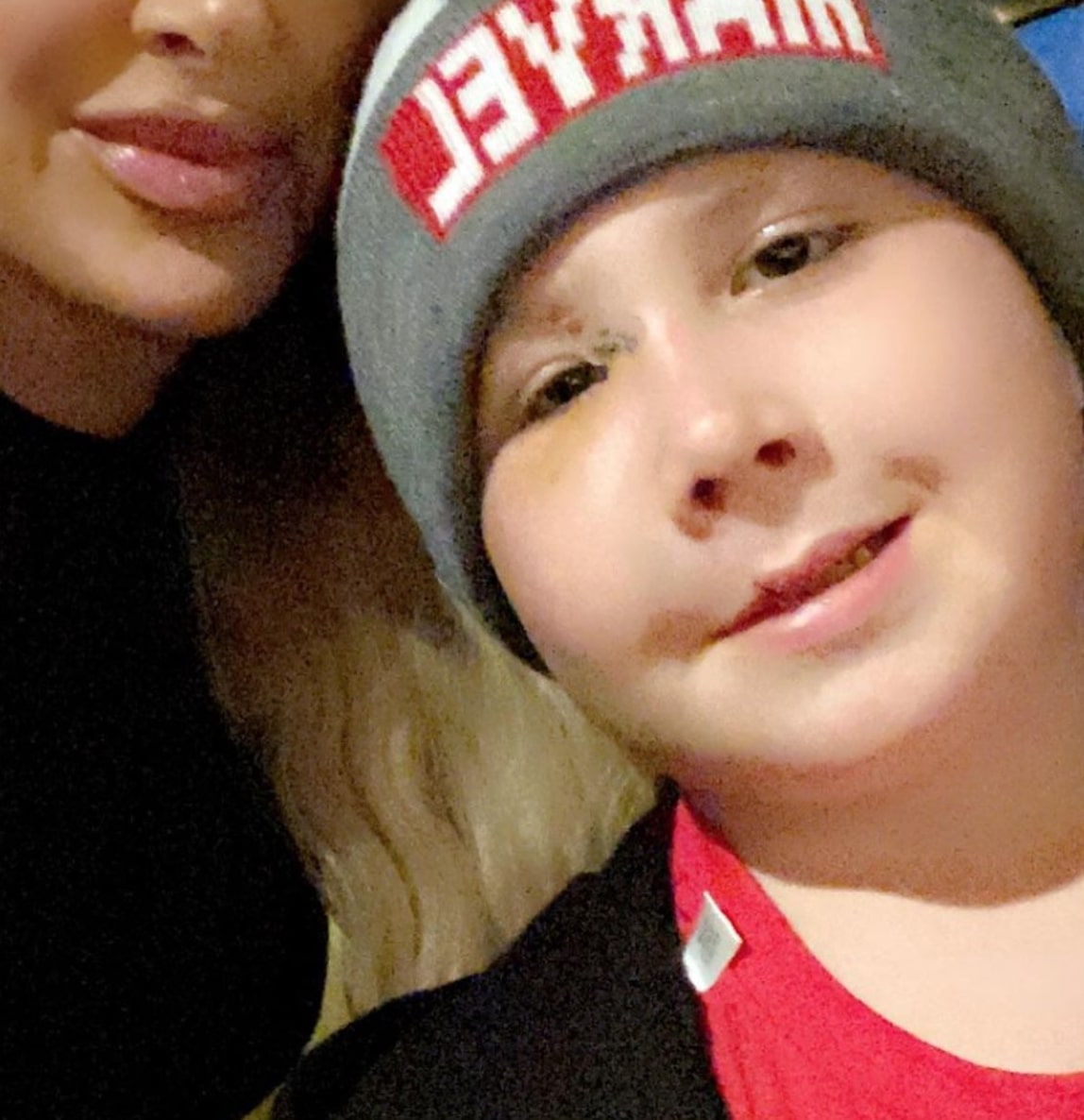 Kim Zolciak Reveals Son Kash Had Reconstructive Surgery