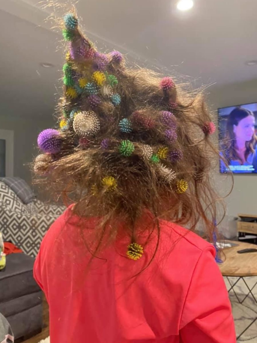 6-Year-Old Daughter Gets 150 Velcro-Like Toys Stuck In Hair