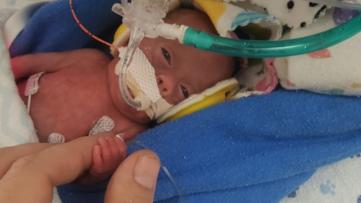 Doctors Gave Baby Richard a Zero Percent Chance of Survival—Now He's Thriving