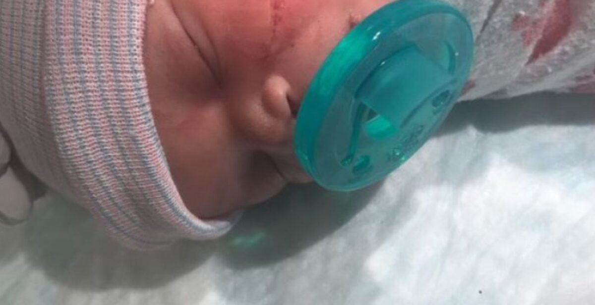 Newborn’s Face Sliced Open During Emergency C-Section, Requires 13 Stitches