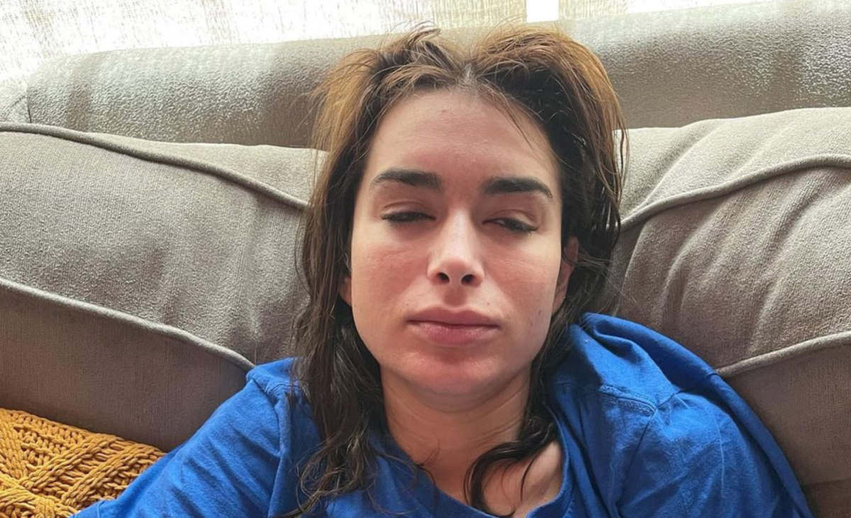 Pregnant Ashley Iaconetti Floored By Pregnancy Acne