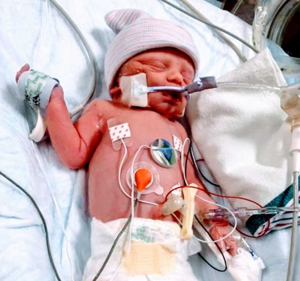 Mom Pens Open Letter About Giving Birth For The First Time While Having COVID-19 And Pneumonia