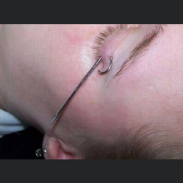 30 Extreme Piercings That Will Make Your Teeth Hurt