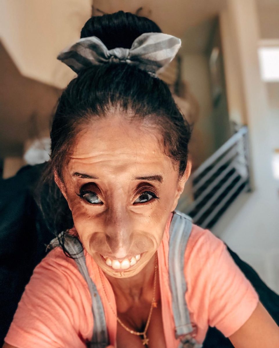 Who Is Lizzie Velasquez?