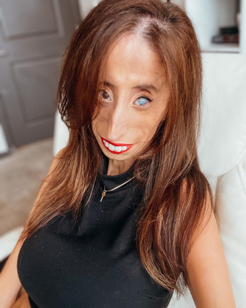 Who Is Lizzie Velasquez?