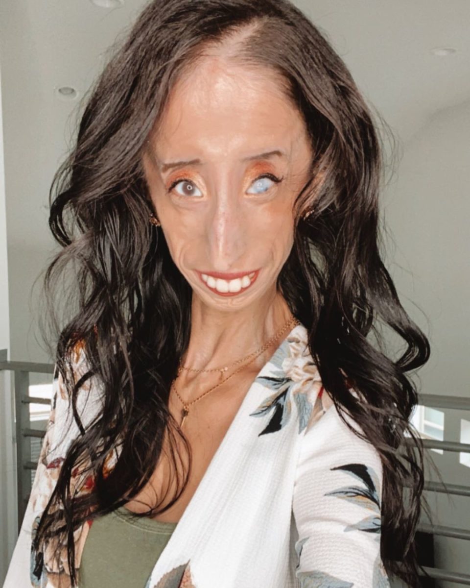 Who Is Lizzie Velasquez?