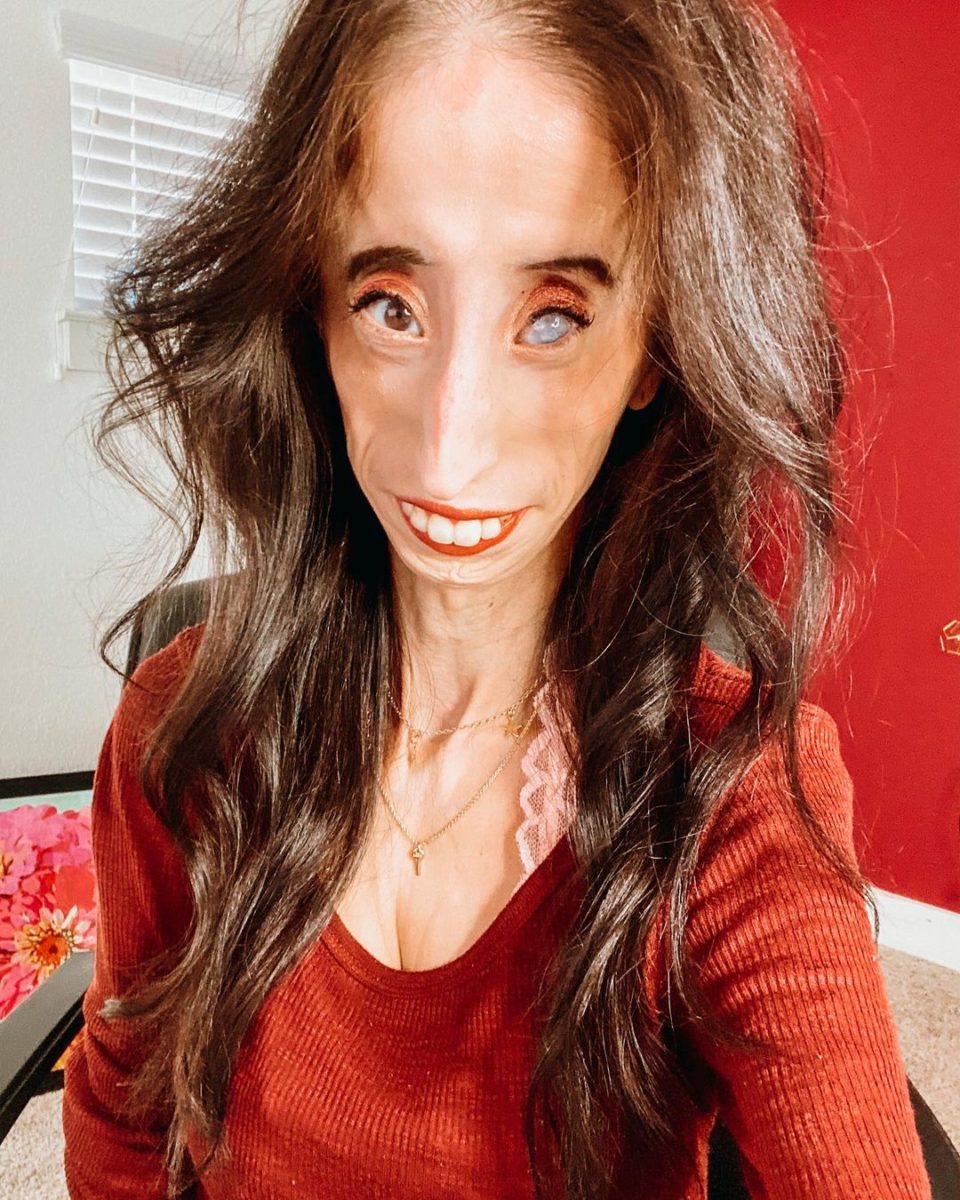 Who Is Lizzie Velasquez?