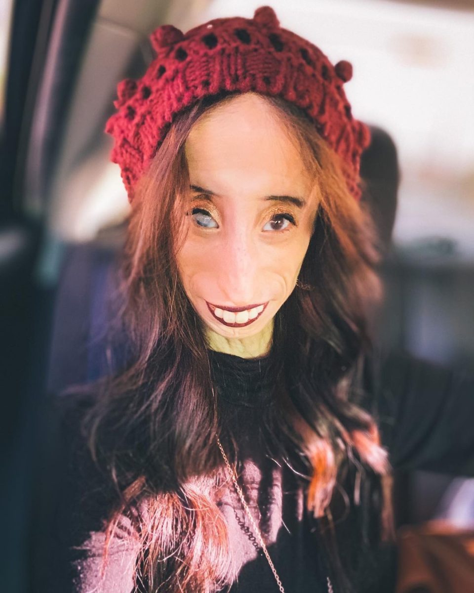 Who Is Lizzie Velasquez?