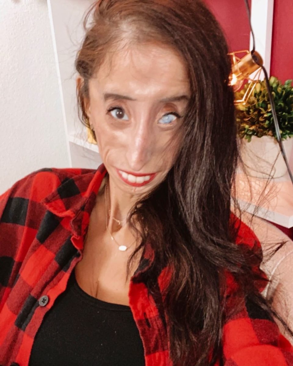 Who Is Lizzie Velasquez?