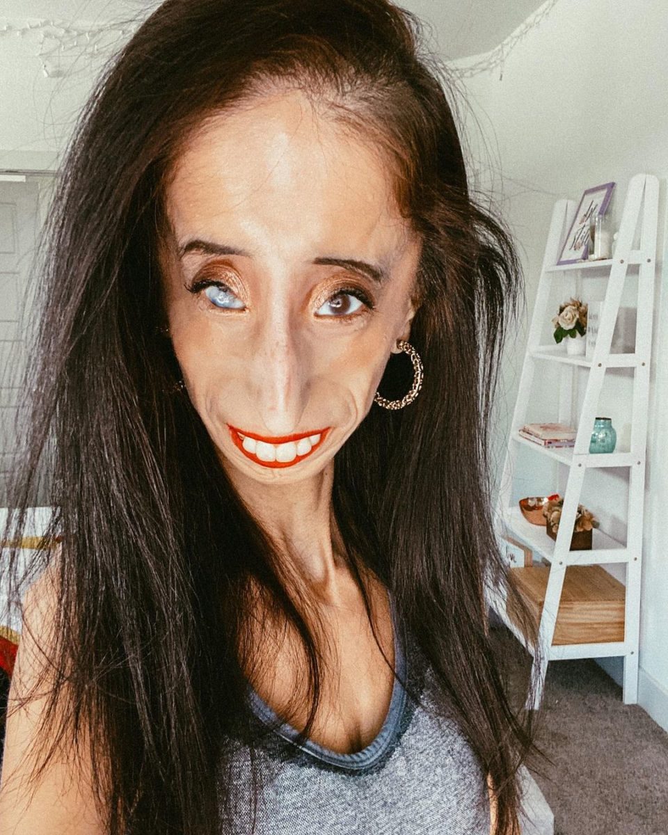 Who Is Lizzie Velasquez?