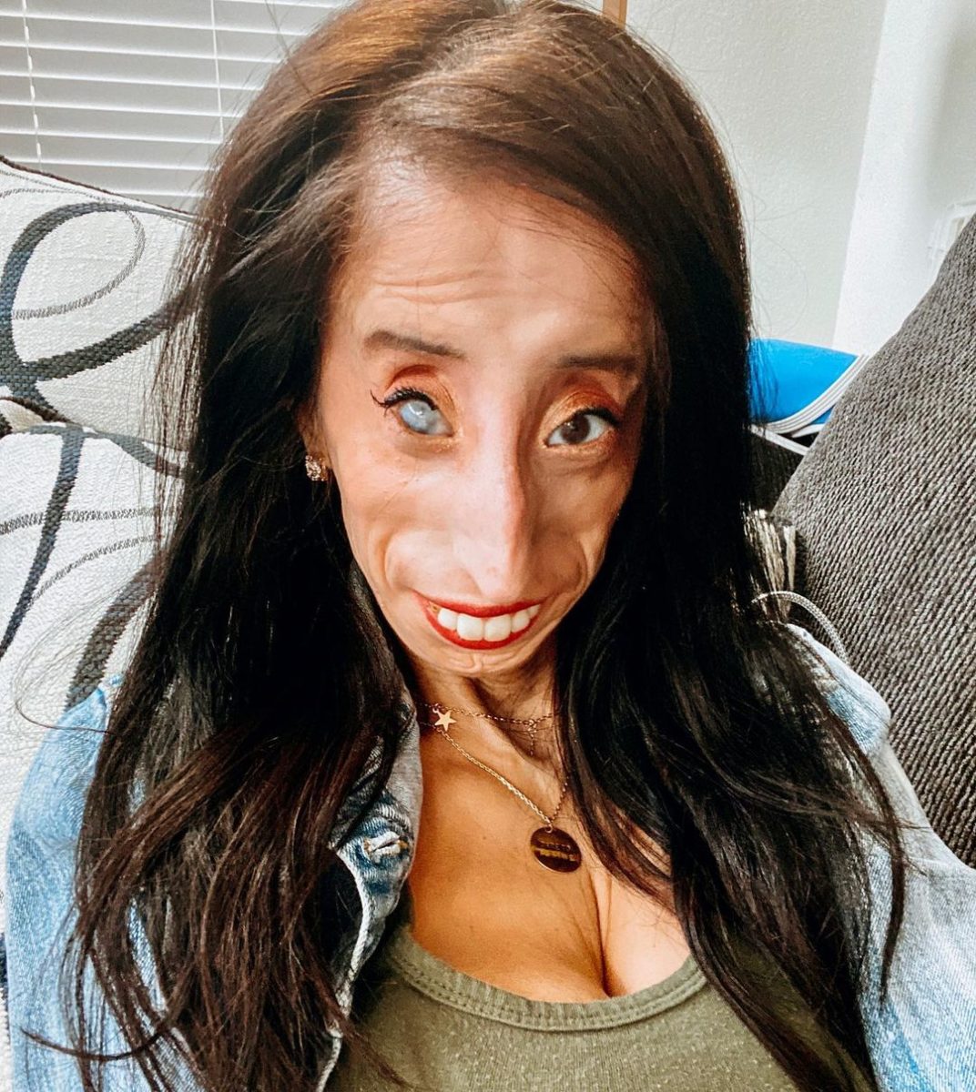 Who Is Lizzie Velasquez?