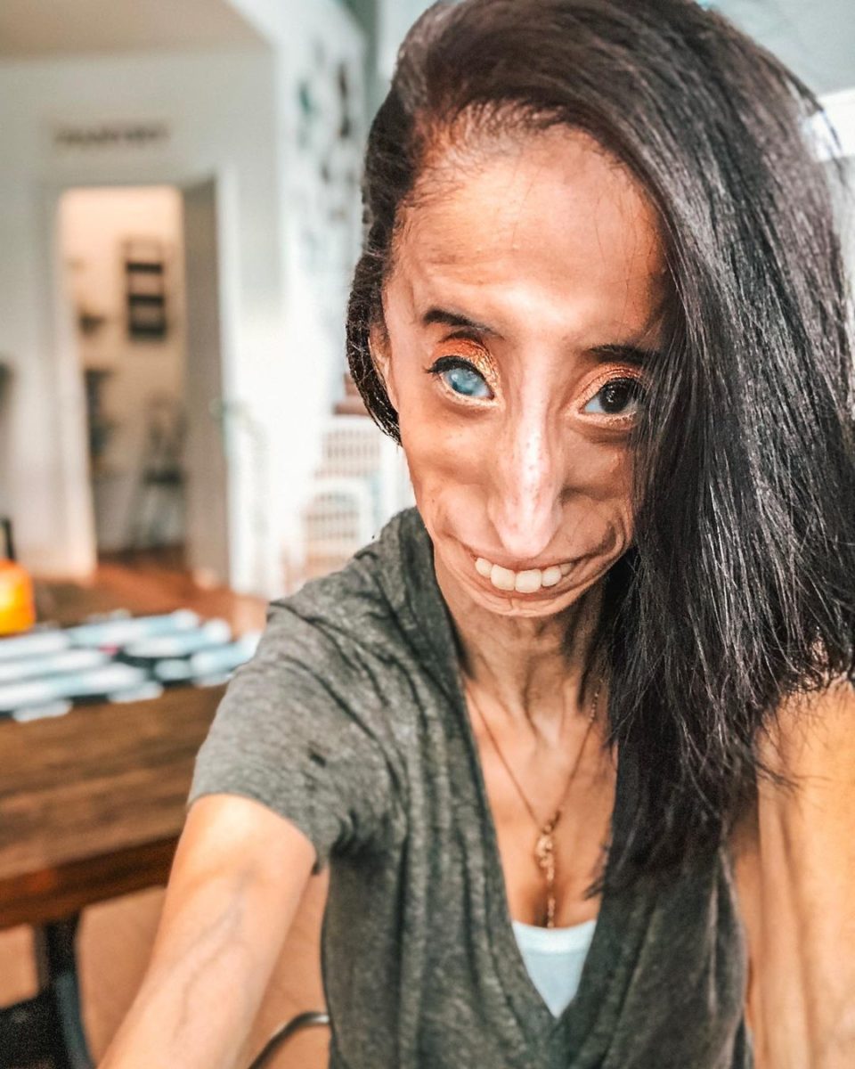 Who Is Lizzie Velasquez?