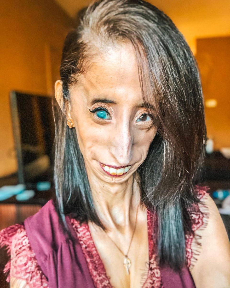 Who Is Lizzie Velasquez?