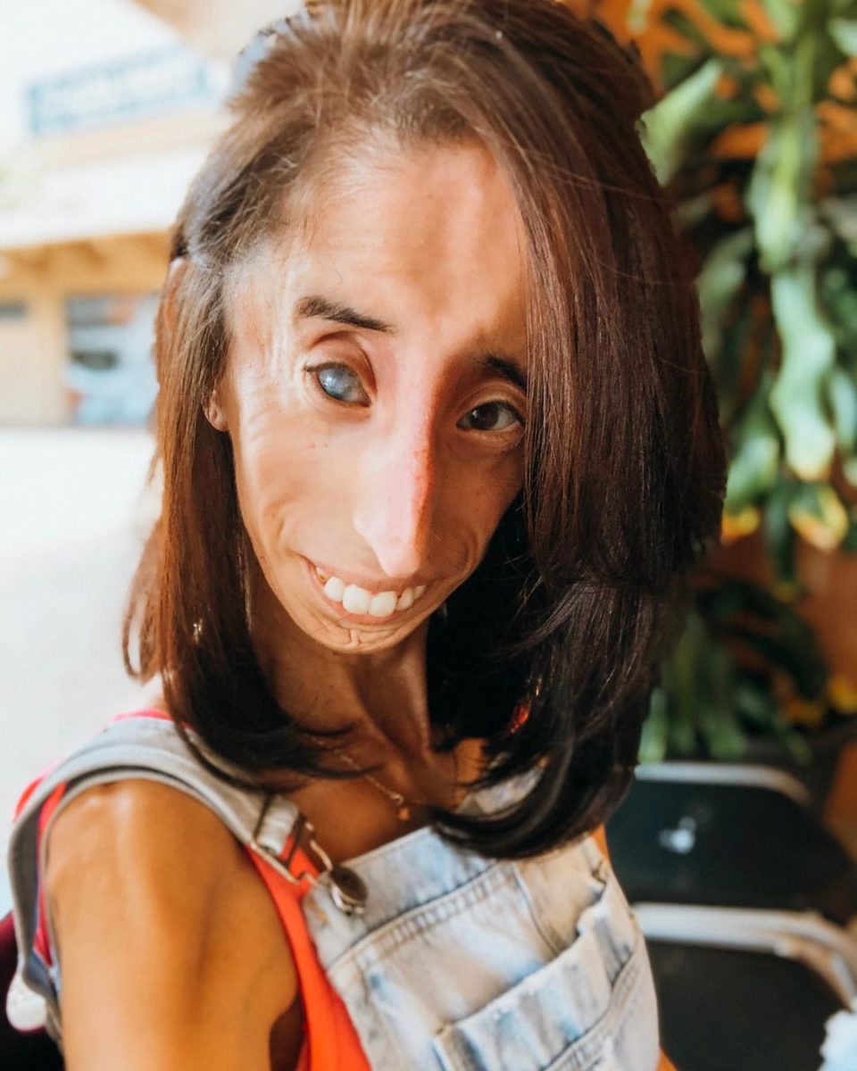 Who Is Lizzie Velasquez?