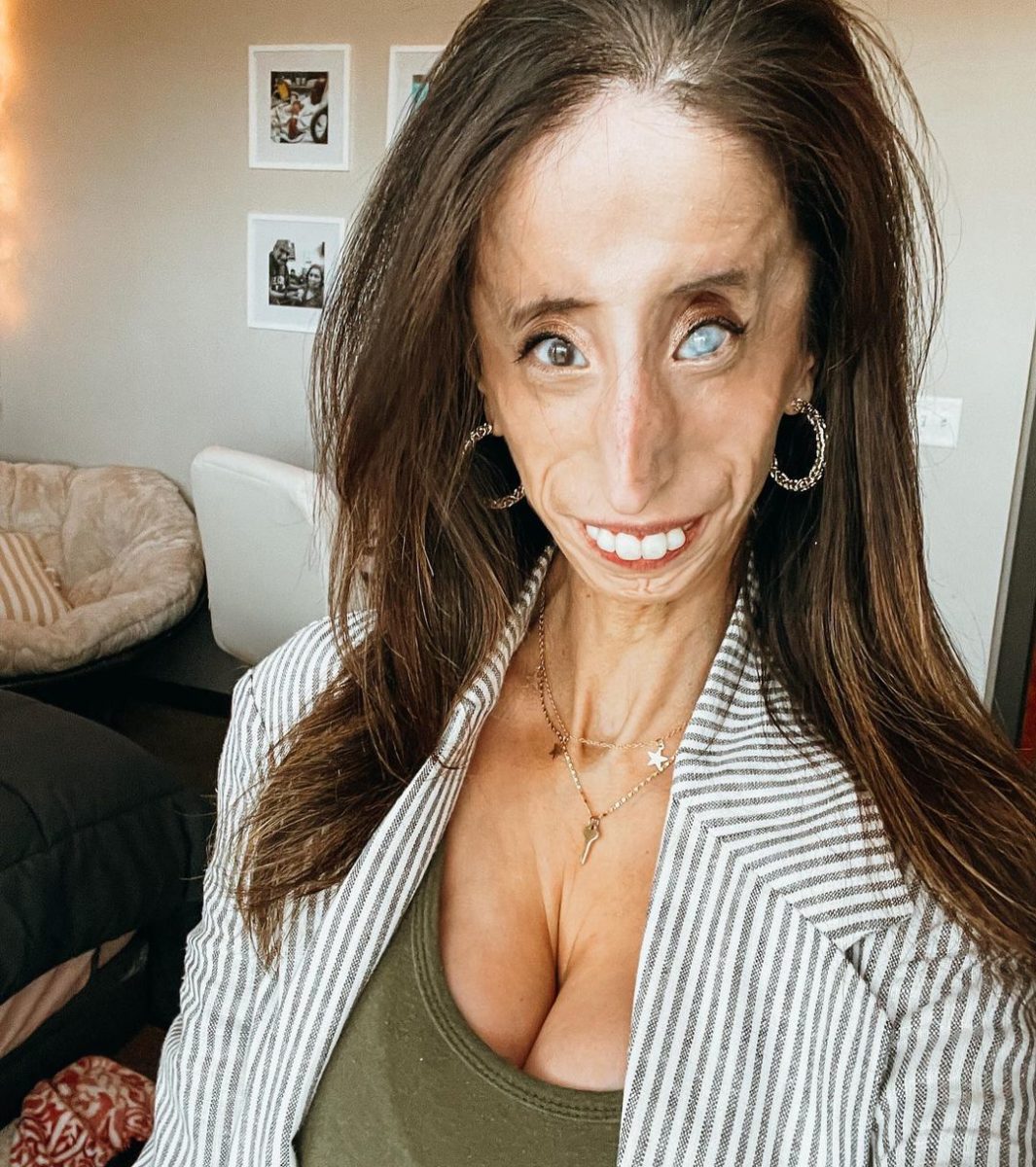 Who Is Lizzie Velasquez?