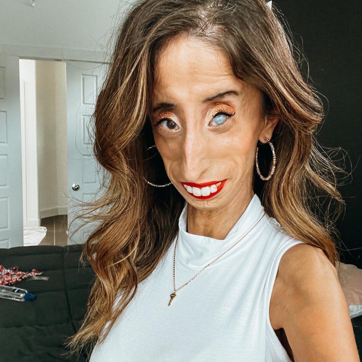 Who Is Lizzie Velasquez?