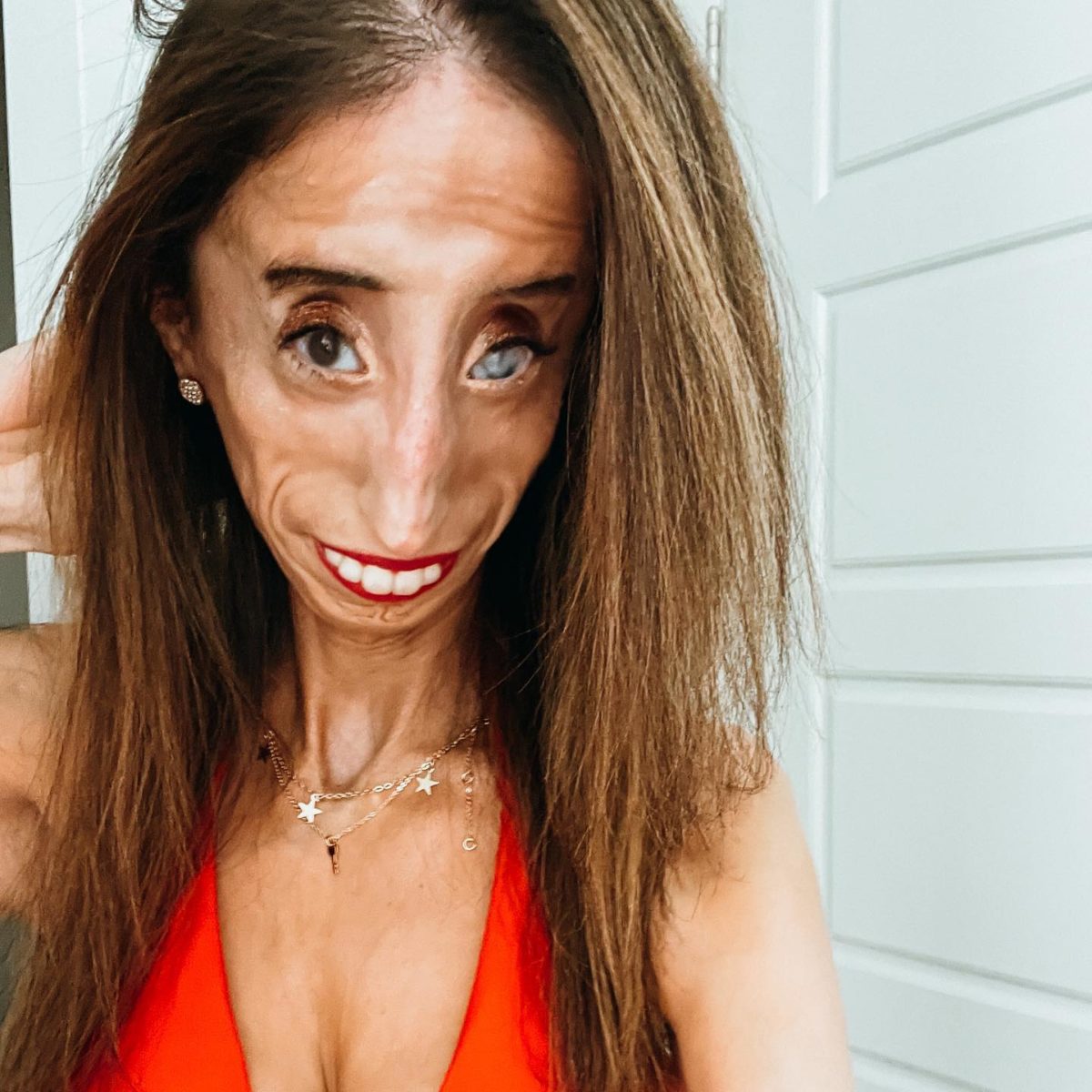 Who Is Lizzie Velasquez?