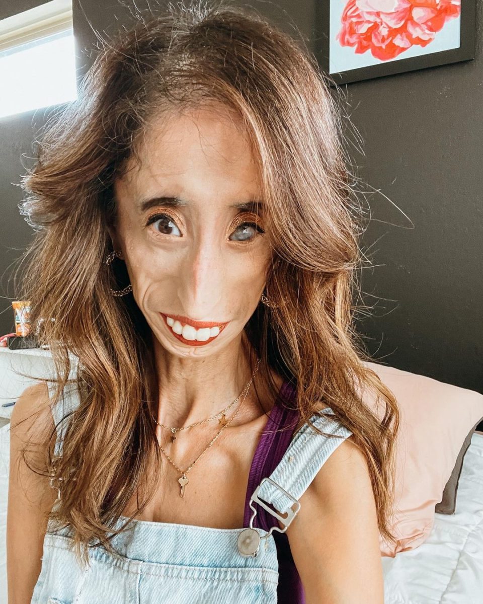 Who Is Lizzie Velasquez?