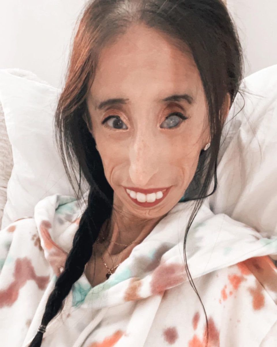 Who Is Lizzie Velasquez?