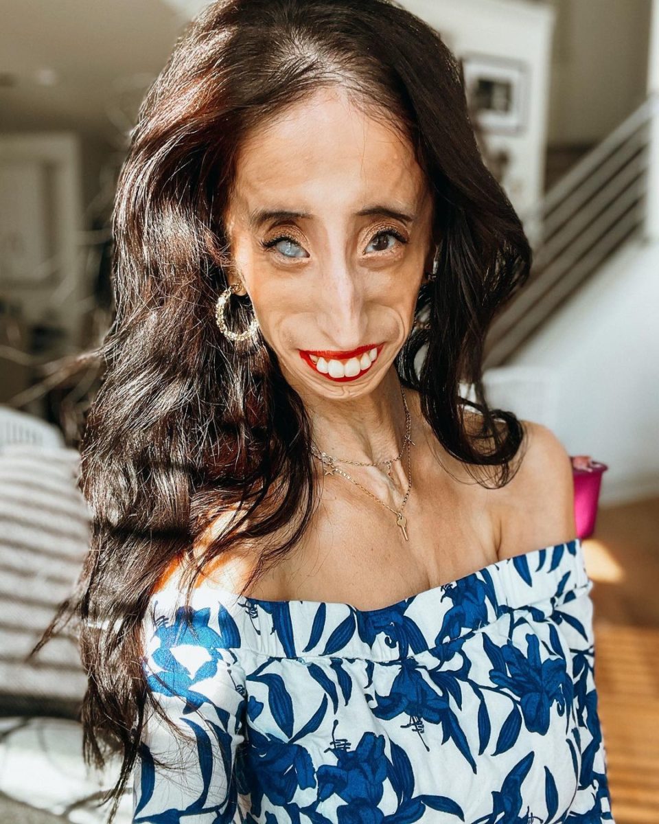 Who Is Lizzie Velasquez?