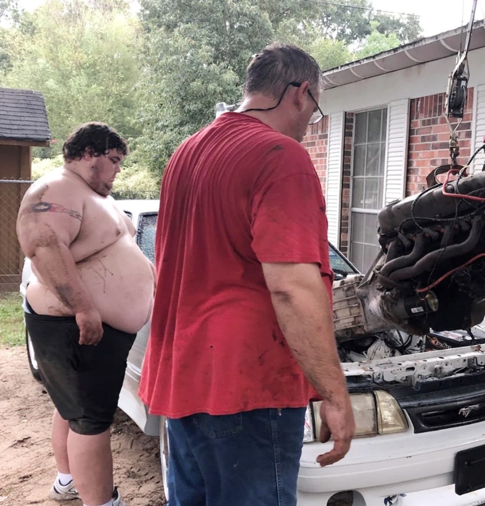 Man Loses 300 Pounds To Be Eligible To Donate Liver To His Dad