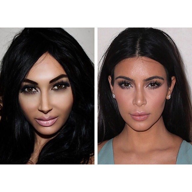 Plastic Surgery to Look Like Celebrities 