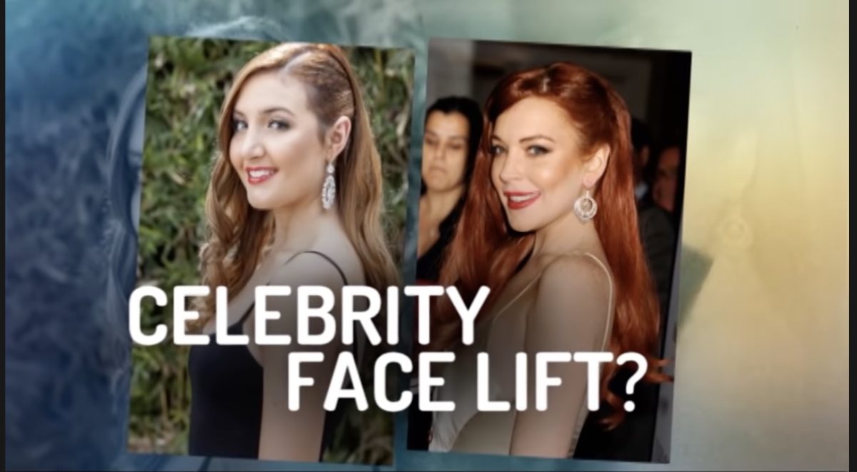 Plastic Surgery to Look Like Celebrities 