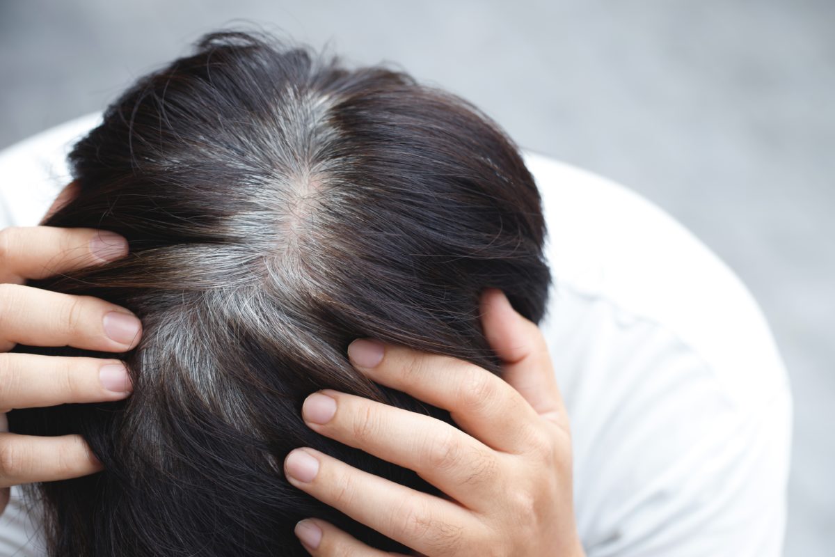 Premature Graying of Hair: Why It Happens & What You Can Do About It | This is called premature graying of hair (PGH), and it’s a real thing.