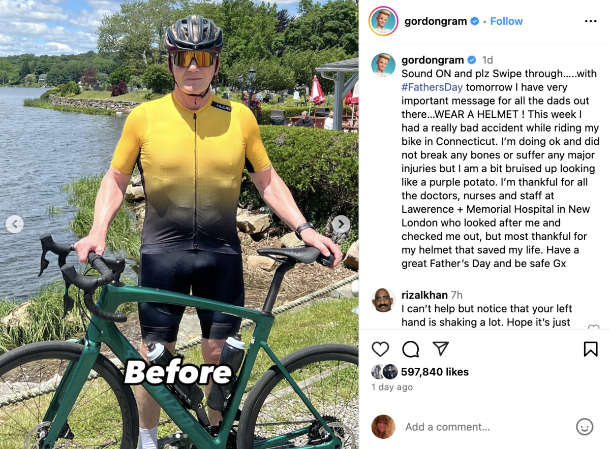 Gordon Ramsay shares jaw dropping injuries after 'horrible' cycling accident: 'Lucky to be here' | Chef Gordon Ramsay is revealing the horrific injury he suffered after getting into a bad bike accident.