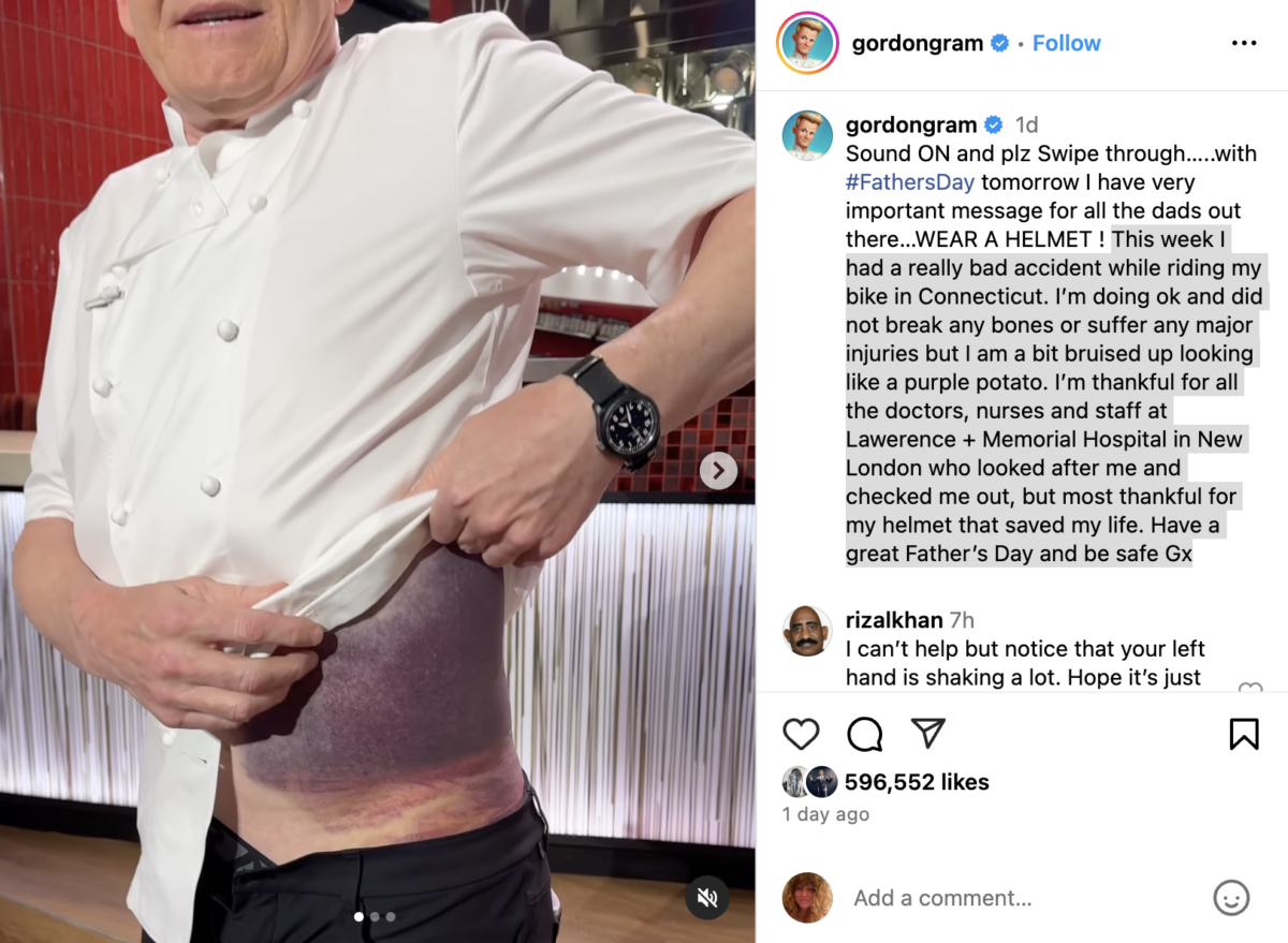 Gordon Ramsay shares jaw dropping injuries after 'horrible' cycling accident: 'Lucky to be here' | Chef Gordon Ramsay is revealing the horrific injury he suffered after getting into a bad bike accident.